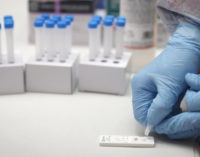La Comunidad de Madrid activa dispositivos de test de antígenos en seis nuevas zonas básicas de salud y dos campus universitarios