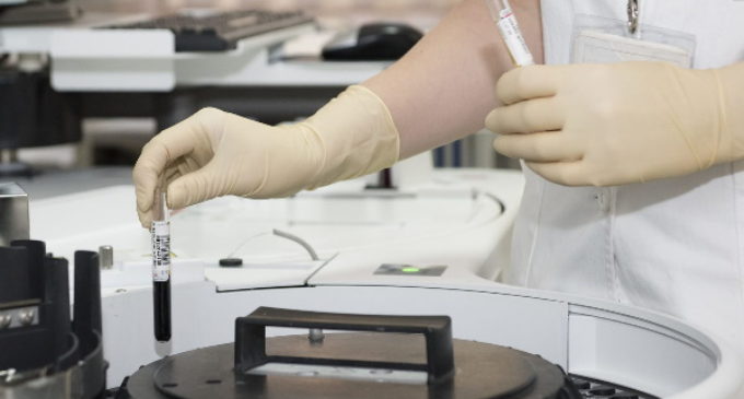 Bioética: COVID-19, nuevas posibilidades en los métodos diagnósticos