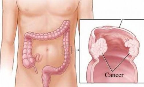 Los madrileños ya pueden pedir cita para el programa de prevención del cáncer de colon a través de la aplicación ‘Cita Sanitaria Madrid’