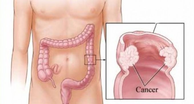 Los madrileños ya pueden pedir cita para el programa de prevención del cáncer de colon a través de la aplicación ‘Cita Sanitaria Madrid’