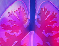 A través de IMDEA, la Comunidad desarrolla una aplicación para monitorizar a los pacientes con cáncer de pulmón