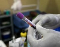 MSF alerta de que las muertes por VIH apenas han disminuido en los últimos años