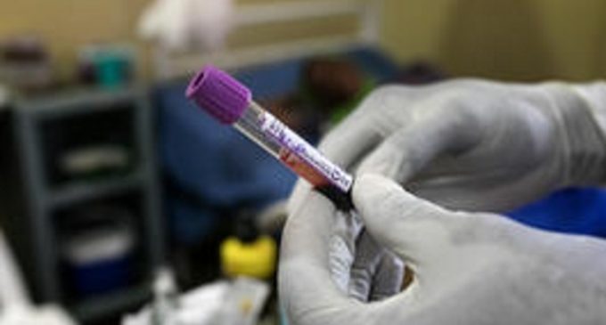 MSF alerta de que las muertes por VIH apenas han disminuido en los últimos años