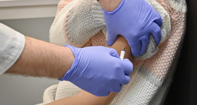 La Comunidad de Madrid comenzará a principios de mayo a vacunar frente al herpes zóster a las personas de 65 y 80 años