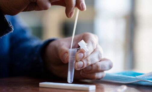 La Comunidad de Madrid entrega hoy más de 1,4 millones de test de antígenos gratuitos en las farmacias
