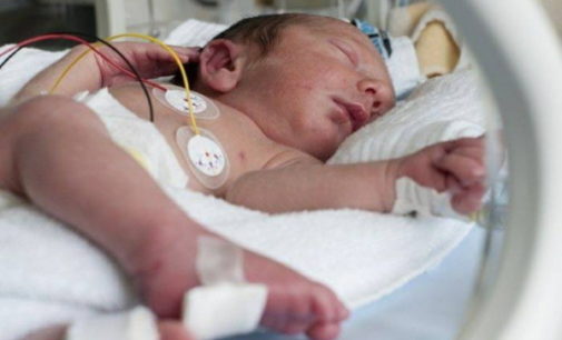 Recién nacidos prematuros: Opinión de la sociedad sobre retirar soporte vital ante graves problemas de salud