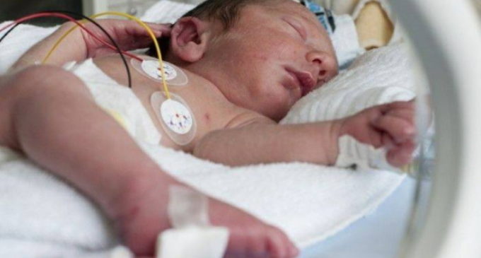 Recién nacidos prematuros: Opinión de la sociedad sobre retirar soporte vital ante graves problemas de salud