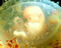 Reproducción asistida: Miles de embriones humanos se pierden con estas técnicas
