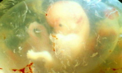 Reproducción asistida: Miles de embriones humanos se pierden con estas técnicas
