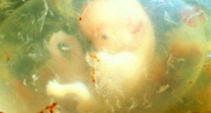 Reproducción asistida: Miles de embriones humanos se pierden con estas técnicas