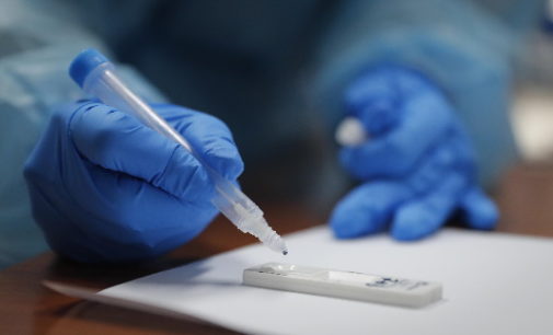 Madrid amplía a otras 14 zonas básicas de salud la realización de test de antígenos