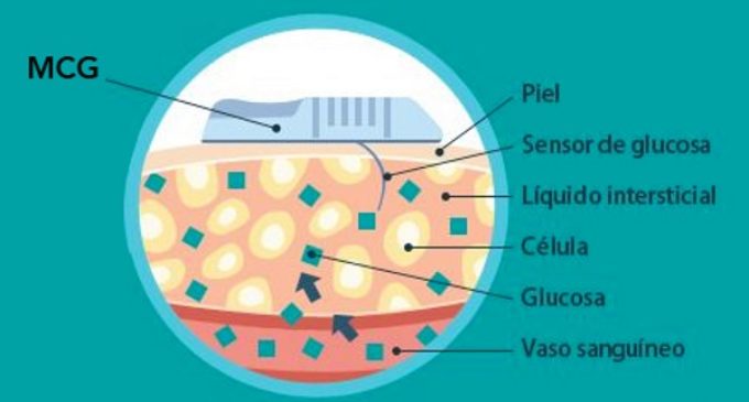 La Comunidad invierte 57,6 millones en tiras reactivas de glucemia y ofrece a pacientes con diabetes tipo 1 medidores de glucosa bajo la piel